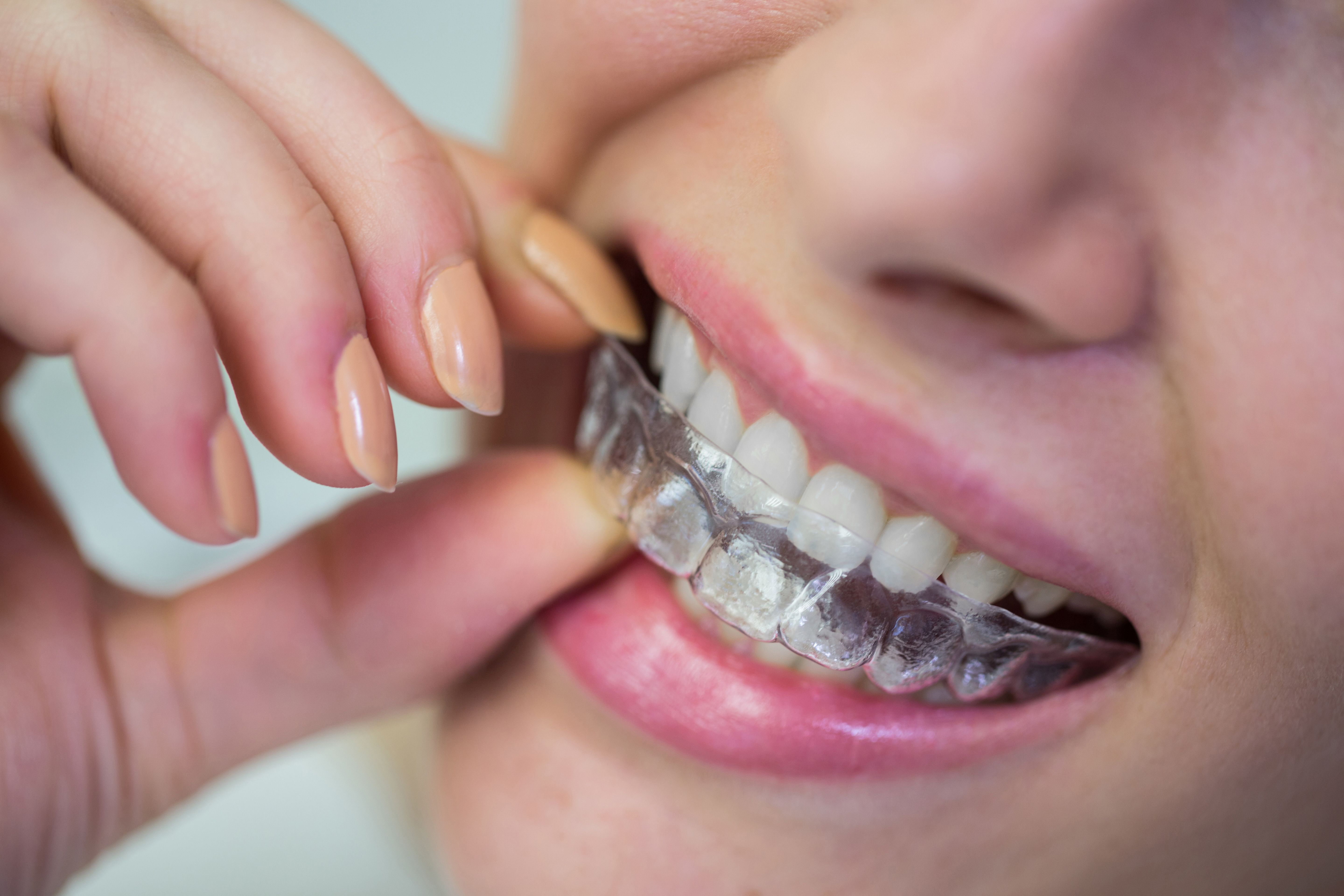 Dental technology