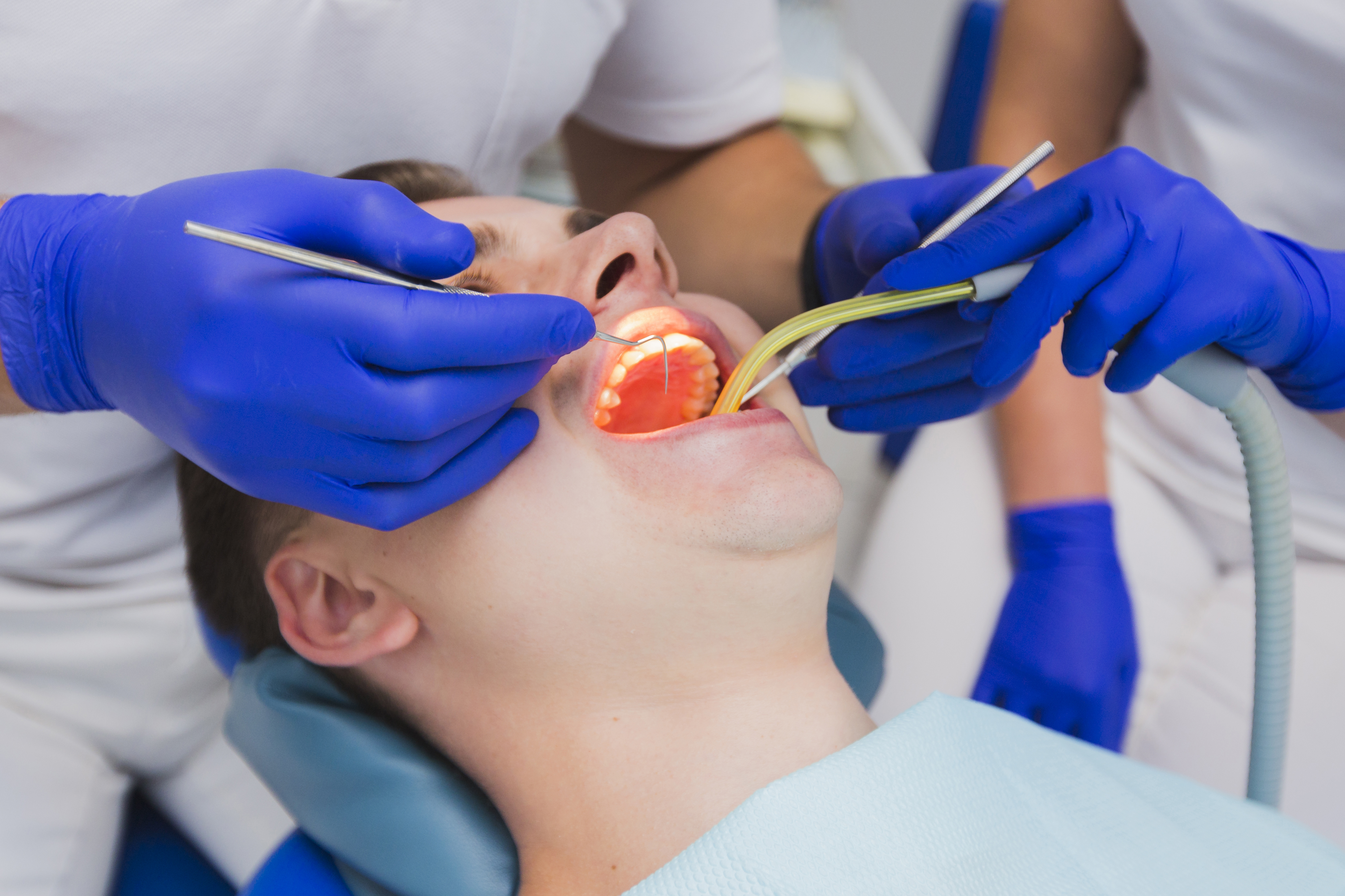 Painless root canal treatment in Chennai